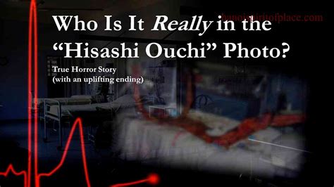 The Harrowing Story Of Hisashi Ouchi: A Real-Life Tragedy Of Radiation ...