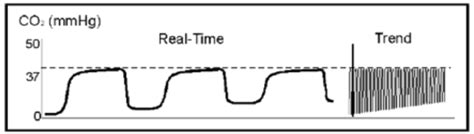 Interpreting Waveform Capnography: Pearls and Pitfalls - emdocs