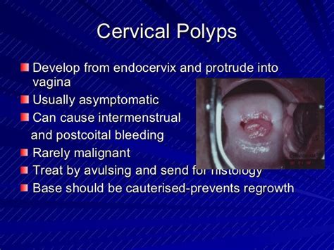 Benign lesions of the cervix, vagina and vulva