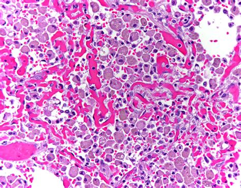 Macrophage Histology