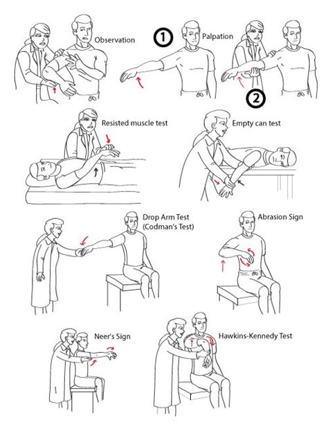 Diagnosing Supraspinatus Tears Supraspinatus Muscle, Rotator Cuff ...