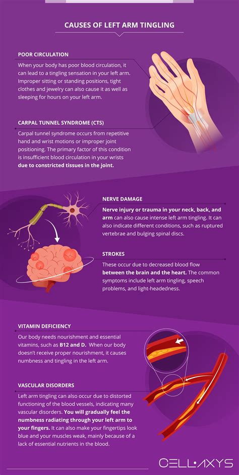 What Causes Left Arm Tingling? How To Treat It? - Cellaxys