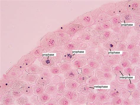 Whitefish Blastula with Mitosis Stages Labeled (400X) | Flickr