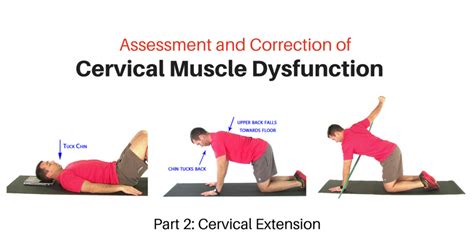 Neck Exercises Archives - My Rehab Connection