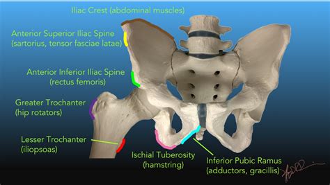 Pelvic Avulsion Fractures | UW Emergency Radiology