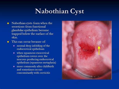 Colposcopy & the Evaluation of Abnormal PAPs - ppt video ... | Medical ...