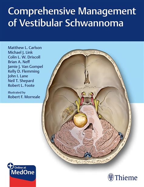 Comprehensive Management of Vestibular Schwannoma: 9781626233317 ...