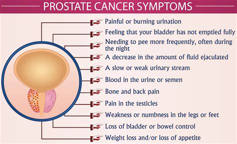 Prostate cancer symptoms infographic vector illustration. Health ...