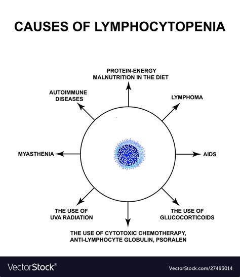 Causes lymphocytopenia decreased lymphocytes Vector Image