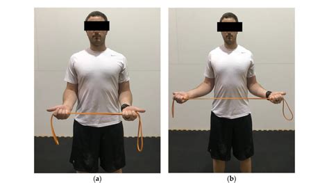 12 Thoracic Outlet Syndrome Exercises for Lasting Relief