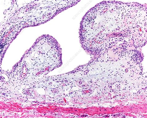 Synovial membrane, light micrograph - Stock Image - C052/8907 - Science ...