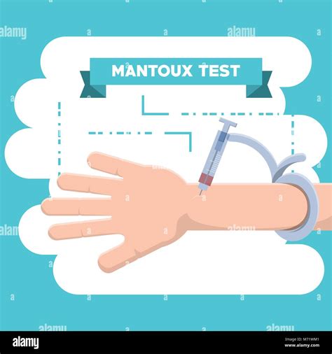 Mantoux test hi-res stock photography and images - Alamy