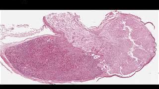 Pituitary Histology