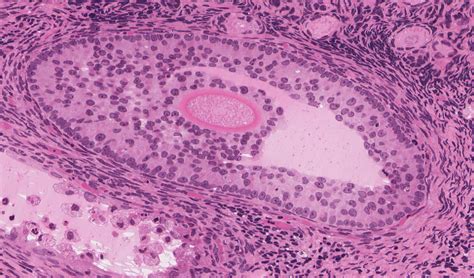 Female Reproductive System | histology