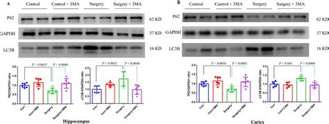 The effects of an autophagy inhibitor on surgery-induced changes of ...