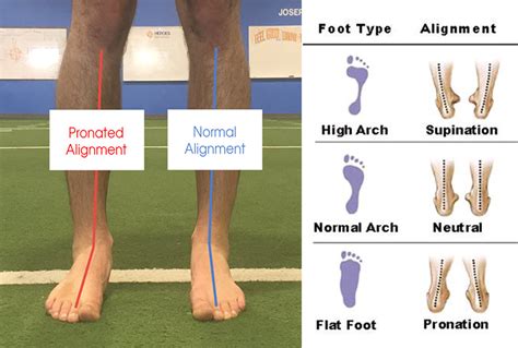 Corrective Exercise for foot and ankle