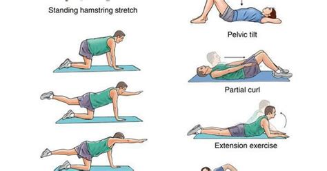 Back pain management | Spinal fusion/nerve damage | Pinterest | Pain ...