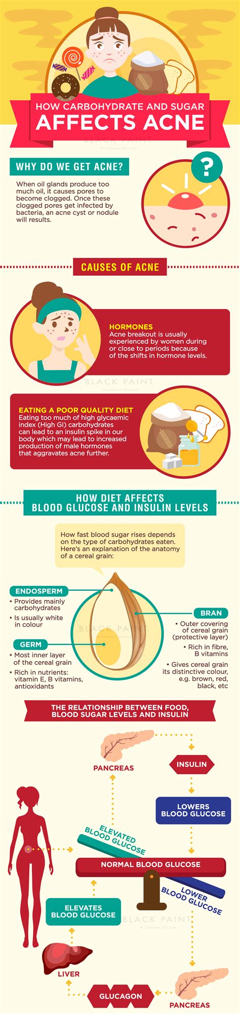 [Infographic] How Carbs and Sugar Can Cause Acne and Health Issues