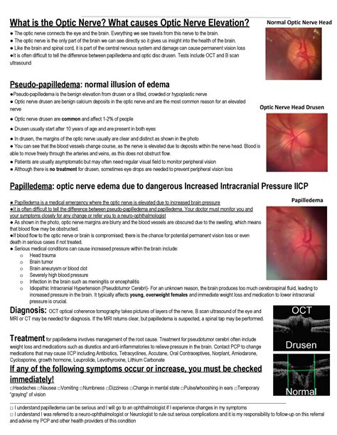 Papilledema