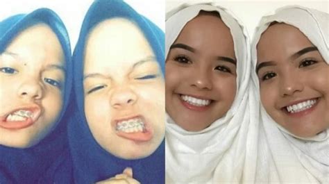 8 Potret Transformasi The Connell Twins, Dulu Berhijab Kini Umbar Aurat ...