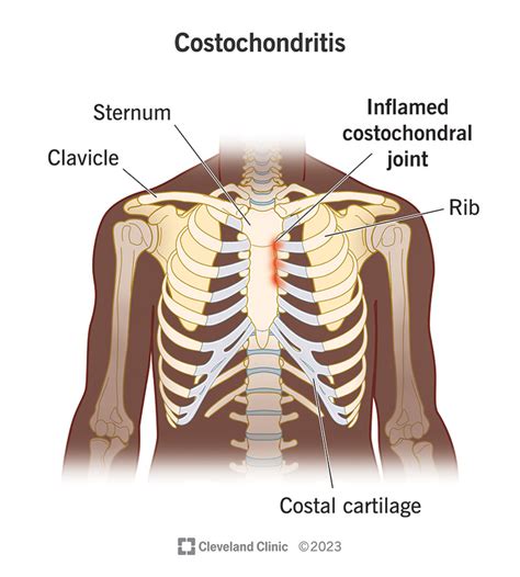 [ST Forum Letter of the Day] (COVID-19) Vaccine hesitancy a serious ...