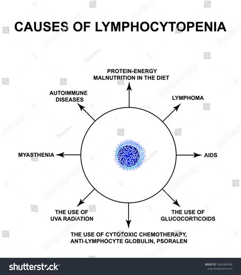 Causes Lymphocytopenia Decreased Lymphocytes Blood Infographics Stock ...