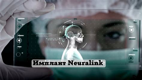 Мозговые импланты Neuralink Илона Маска отказали тестировать на людях ...