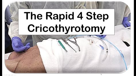 The Rapid 4 Step Cricothyrotomy Technique - YouTube