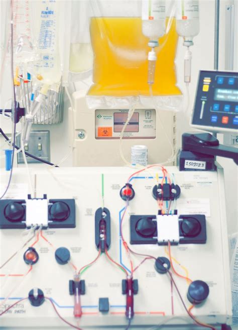 Plasmapheresis - Ask Hematologist | Understand Hematology