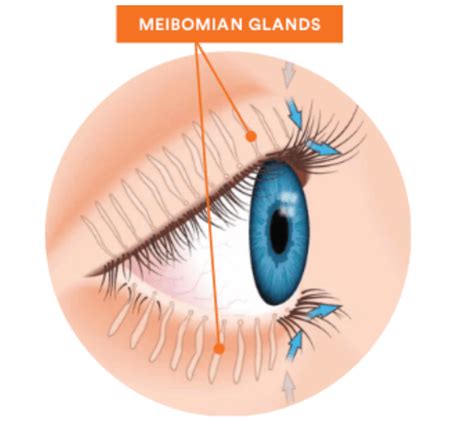 Meibomian-Glands-v2 - Brenart Eye Clinic