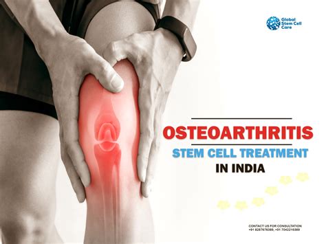 Exploring the Benefits of Osteoarthritis Stem Cell Treatment in India