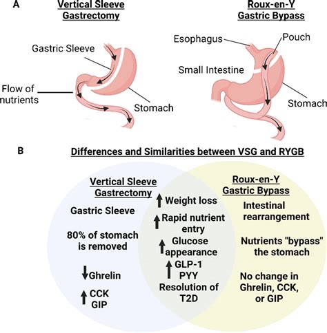 Anatomical and metabolic changes induced by vertical sleeve gastrectomy ...