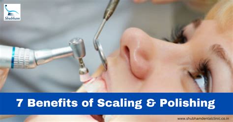 7 Benefits of scaling and polishing - Dr. Rinku Mittal - Medium