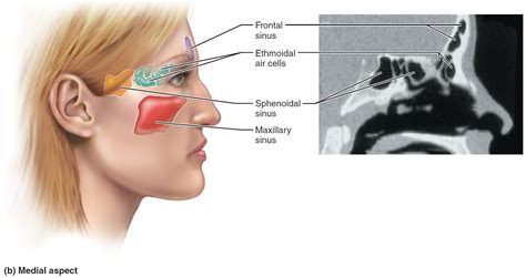 Chronic Sinusitis - Causes, Symptoms, Surgery, and Treatment