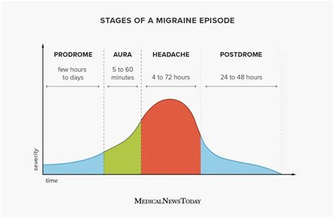 Migraine timeline, stages, durations, and recovery | Anesthesia Experts