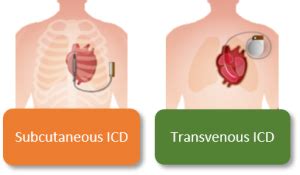 Device-related complications ICD - ERN GUARD-Heart