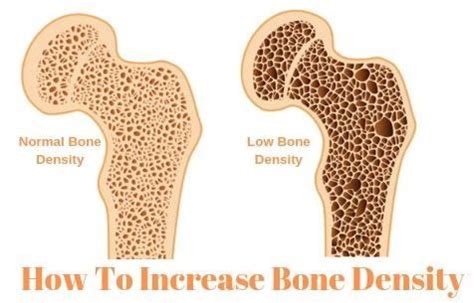 The Health Talks - All About Health | Increase bone density, Low bone ...