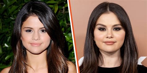 Selena Gomez & Plastic Surgery: Experts Claim She Had Work Done