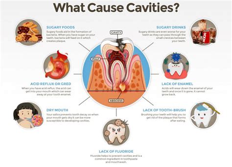 How does a tooth decay? – Sabka Dentist – Top Dental Clinic Chain In ...