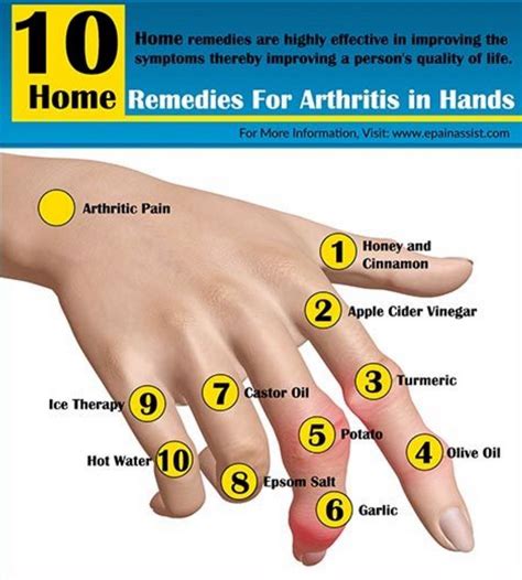 Arthritis Home Remedies Early Symptoms Best Tips | Home remedies for ...