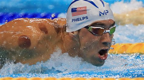 Michael Phelps does cupping — is it something worth paying for ...