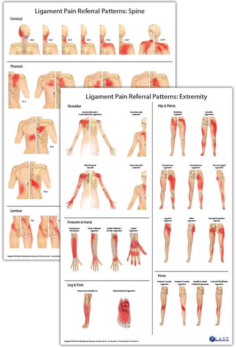 Ligament Pain Referral Pattern Posters – Products Directory | Massage ...