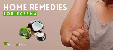 9 Home Remedies for Skin Rashes and Itching that Work [Naturally]