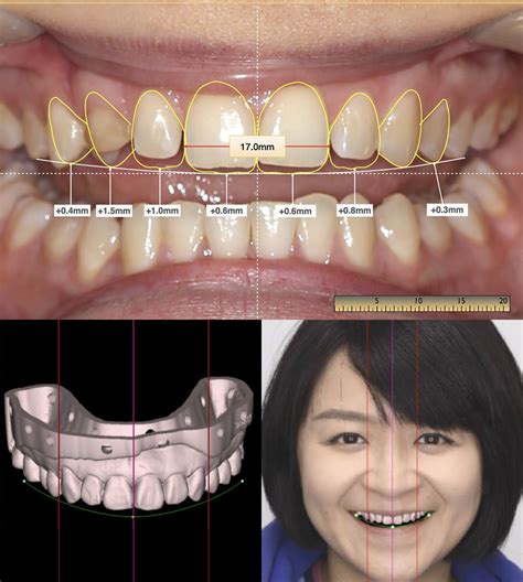 Digital Smile Design - Unley Dentist | Malvern Dental & Smile Design