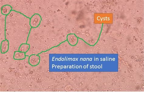 Endolimax nana in saline preparation : Introduction and morphology