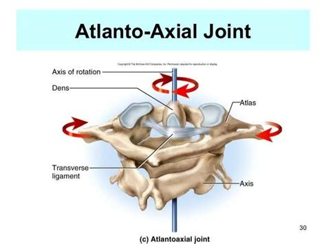 Pictures Of Atlas Axis Joint