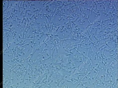 Lactobacillus Bulgaricus Under Microscope