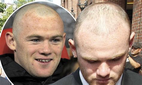 Wayne Rooney hair transplant: Was that £30k really money well spent ...