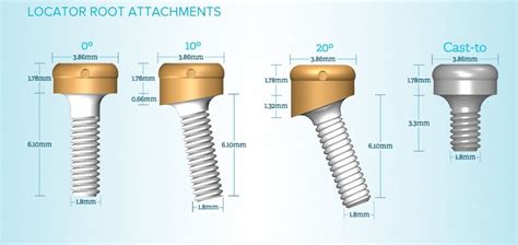 LOCATOR Implant Attachment System | Zest Dental Solutions