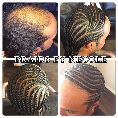 14 Extraordinary Alopecia Camouflage Cornrows By Braids By Necole ...